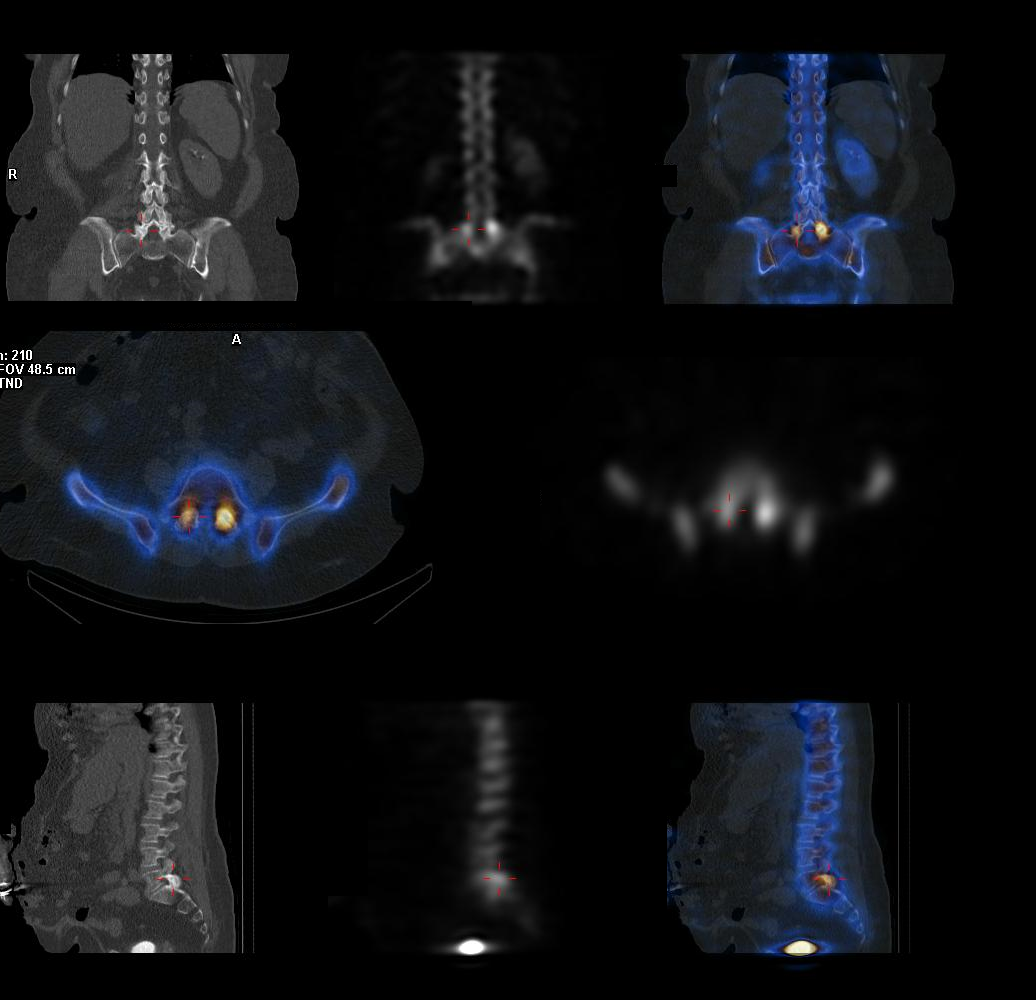 Nuclear Medicine and PET Northern Imaging